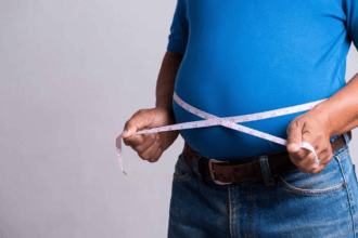 Obesitas bisa diatasi dengan gaya hidup sehat.