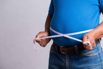 Obesitas bisa diatasi dengan gaya hidup sehat.