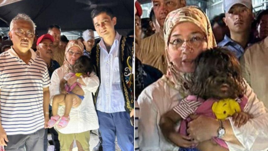 Ratu Malaysia adopsi anak balita yang mengidap sindrom manusia serigal. (Foto : Tribune Style).