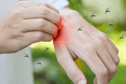 Gejala Demam Berdarah