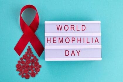 Hari Hemofilia (Foto : Tribun)