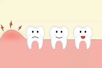 Gusi Bengkak (Foto : Halodoc)