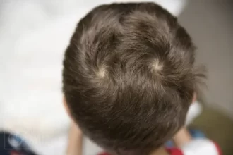 Unyeng-unyeng kepala (Foto : Orami)